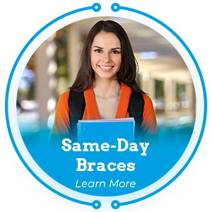 same day braces learn more