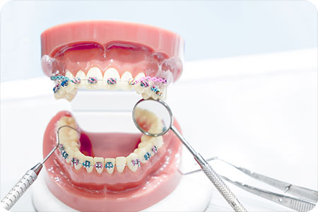 invisalign in hoover