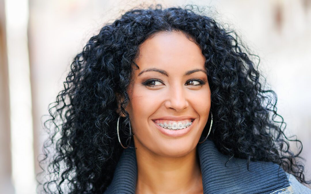 Can You Get Braces with a Crown? Important Considerations