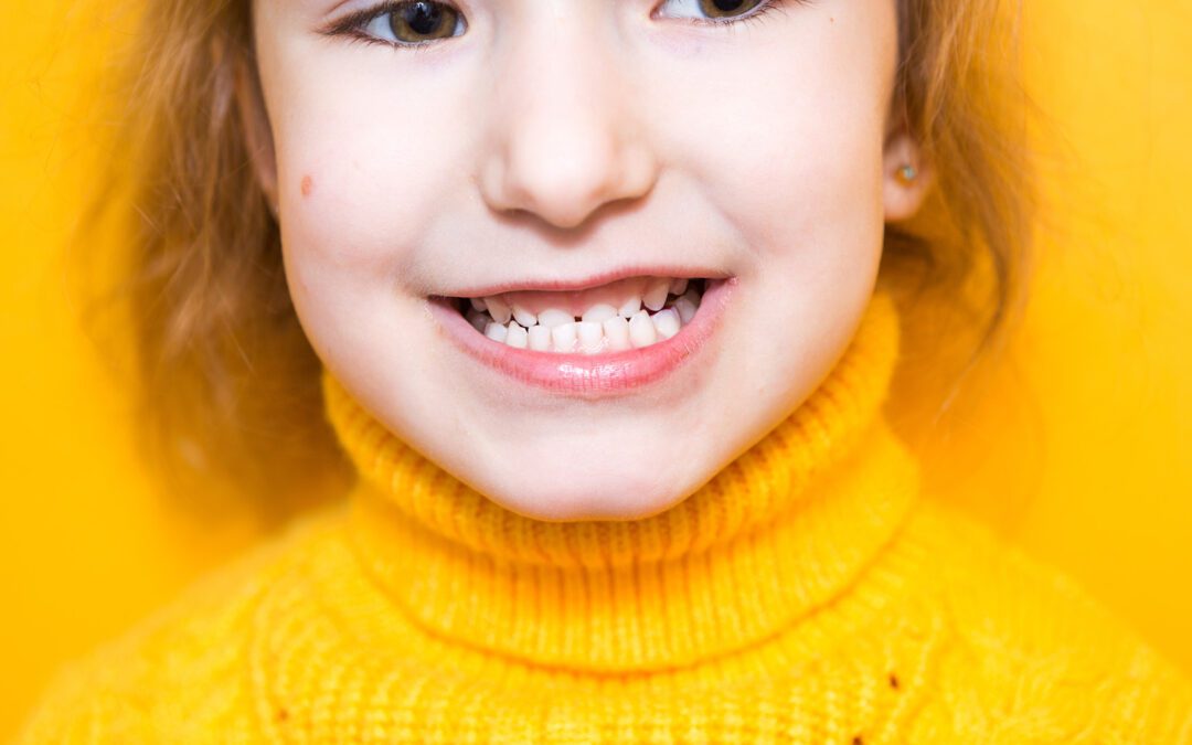 What Is Malocclusion?