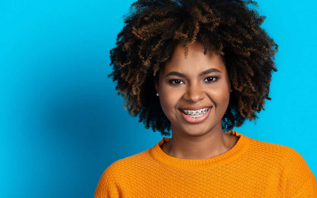 How Braces Work: A Comprehensive Guide