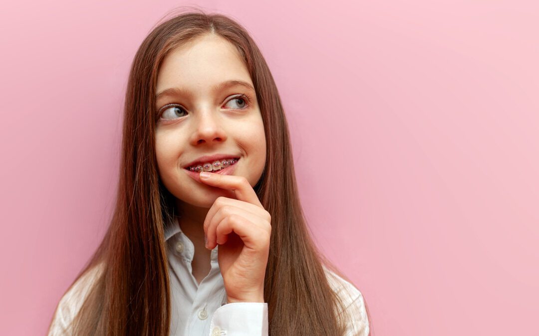 Myths About Braces That Are Totally Wrong