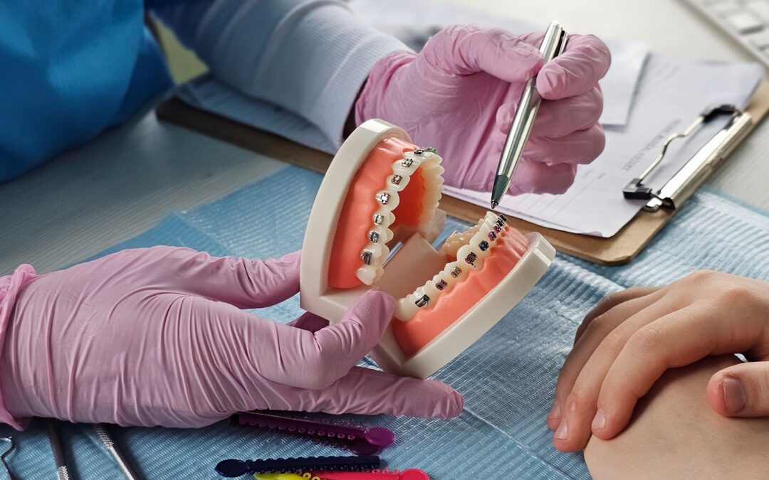 Understanding Teeth Not Aligned When Biting