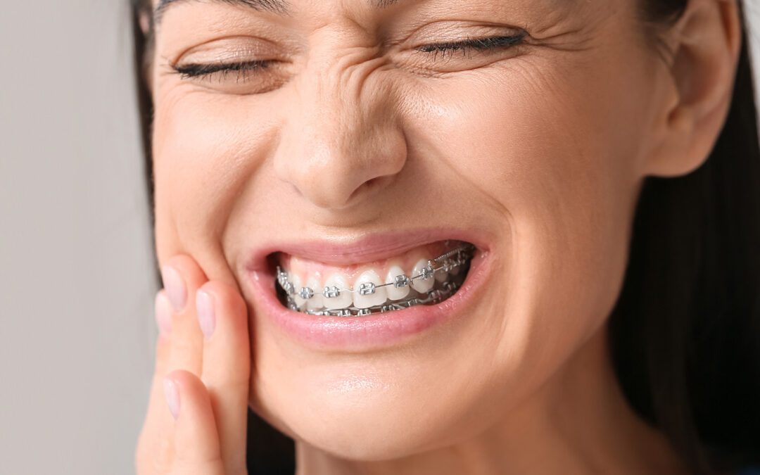 How to Treat Pain at Home After Getting Braces: Effective Solutions