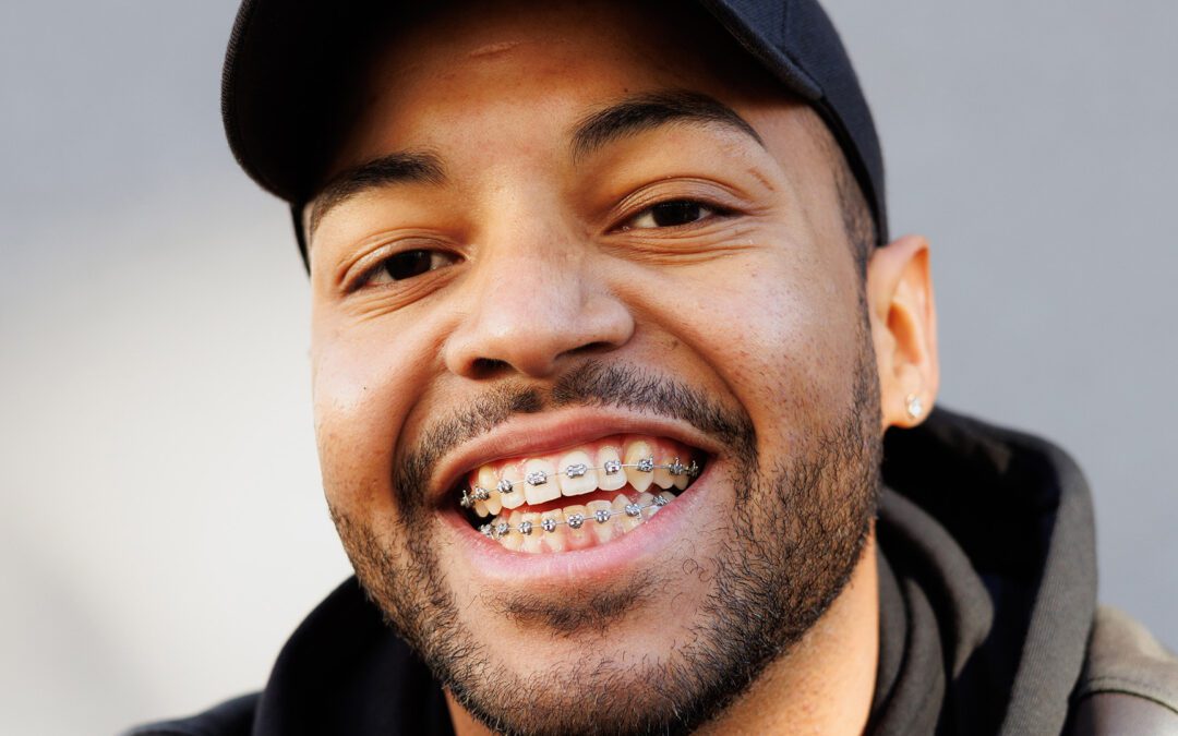 Why You Should Use Your HSA for Orthodontic Treatment