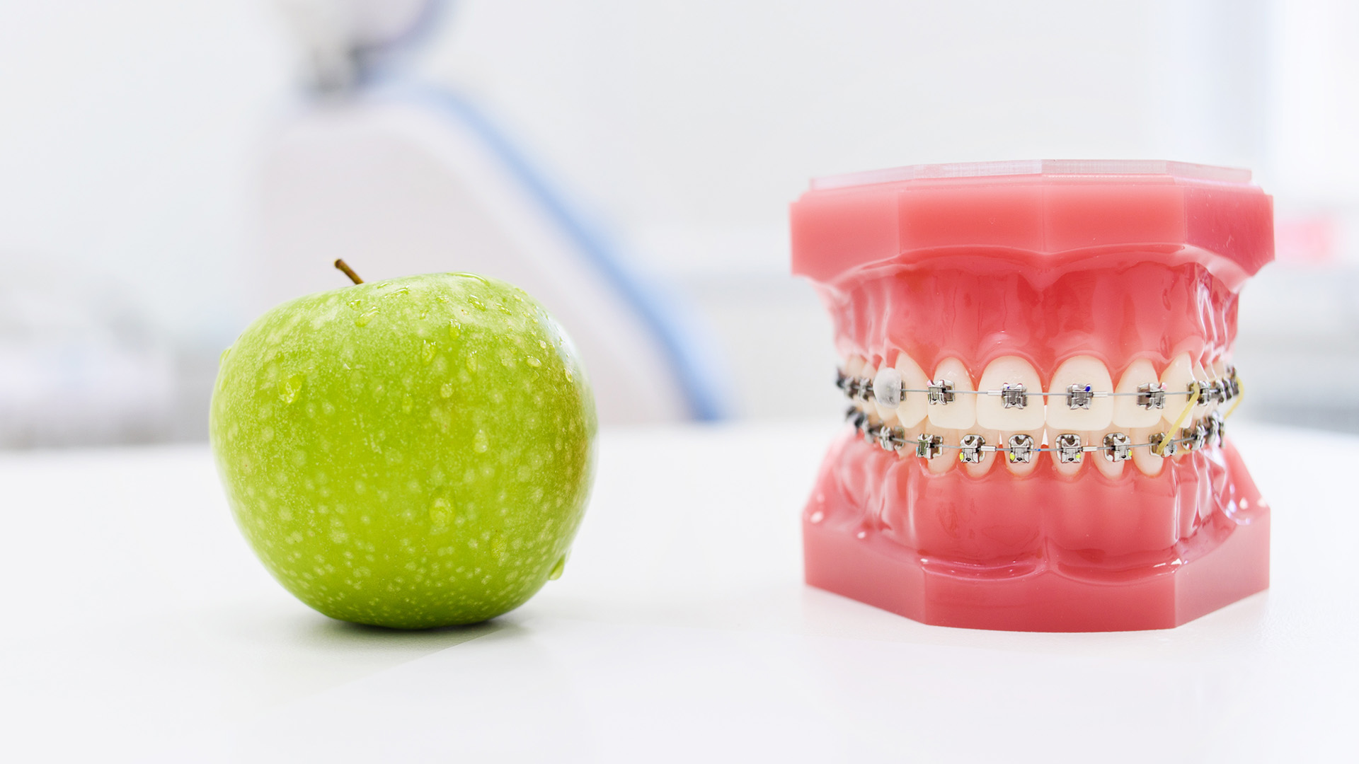 Braces Friendly Food: What to Eat and Avoid