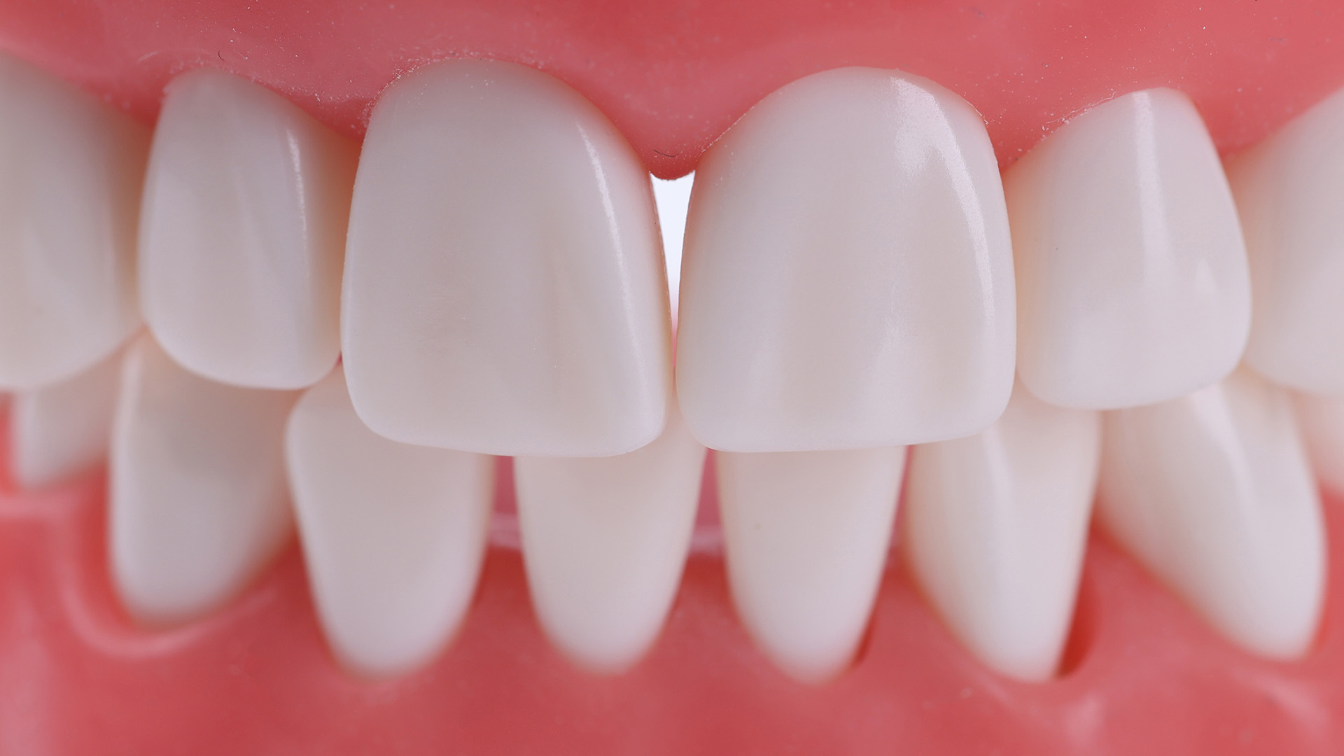 What Does a Perfect Bite Alignment Look Like?