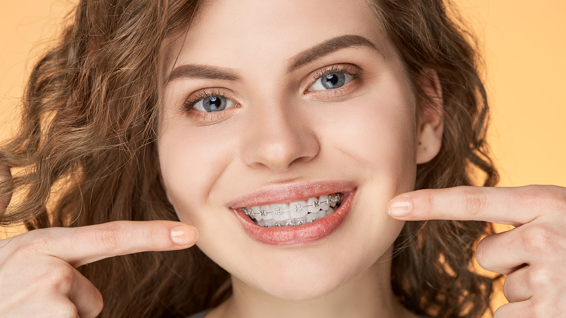 What to Know About Getting Braces
