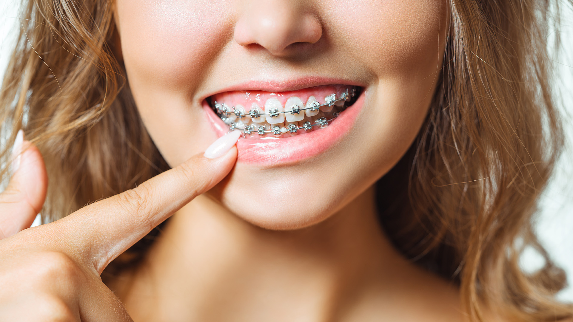 What Does Orthodontia Coverage Mean?