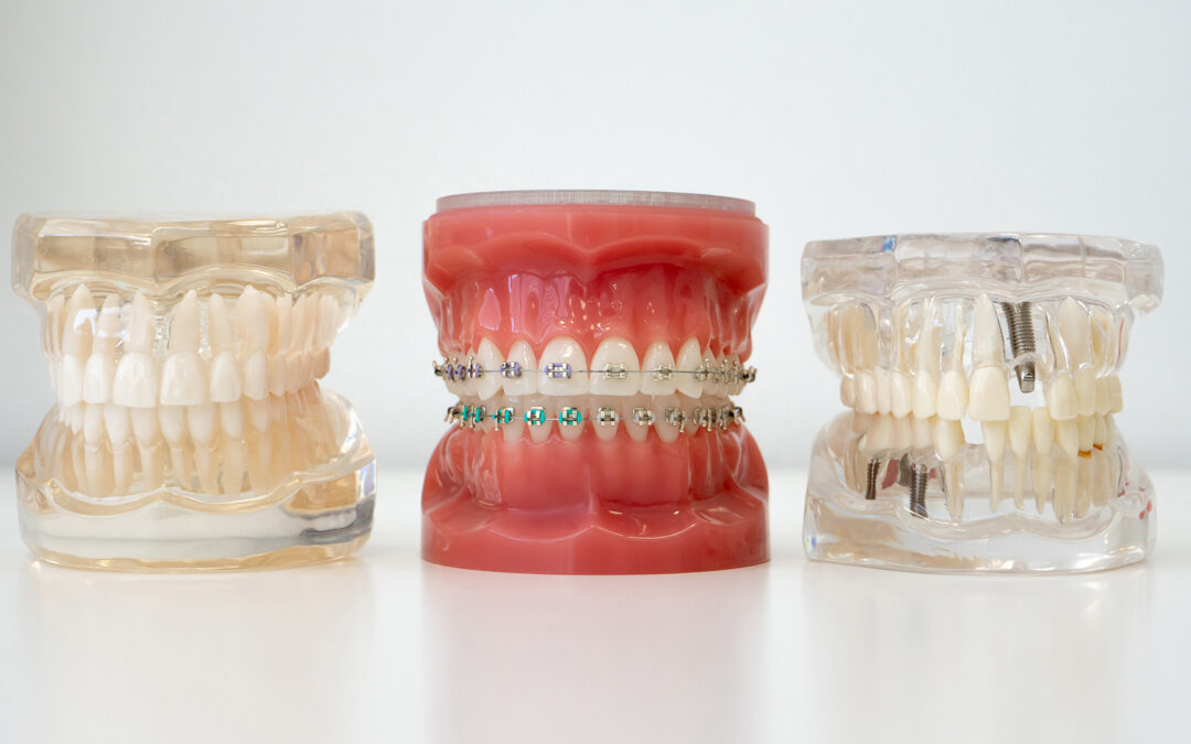 Braces Emergency Care Guide