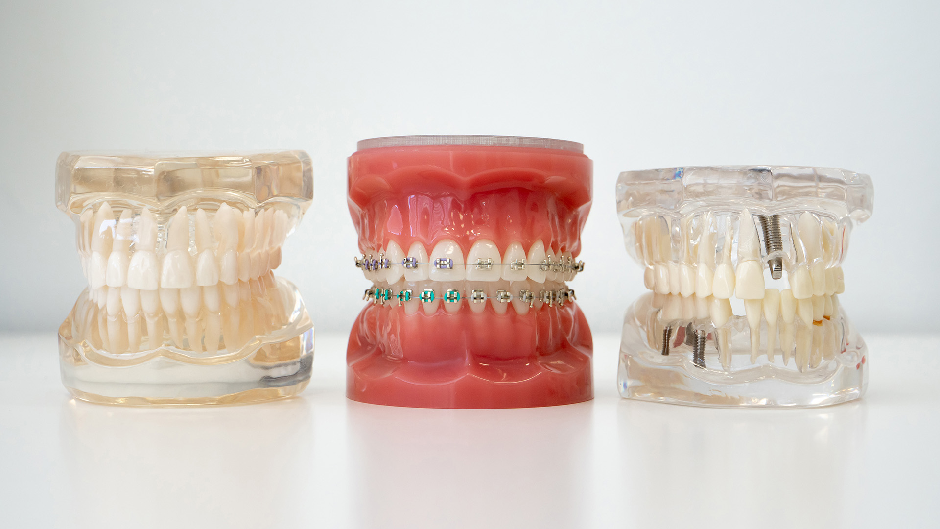 Braces Emergency Care Guide