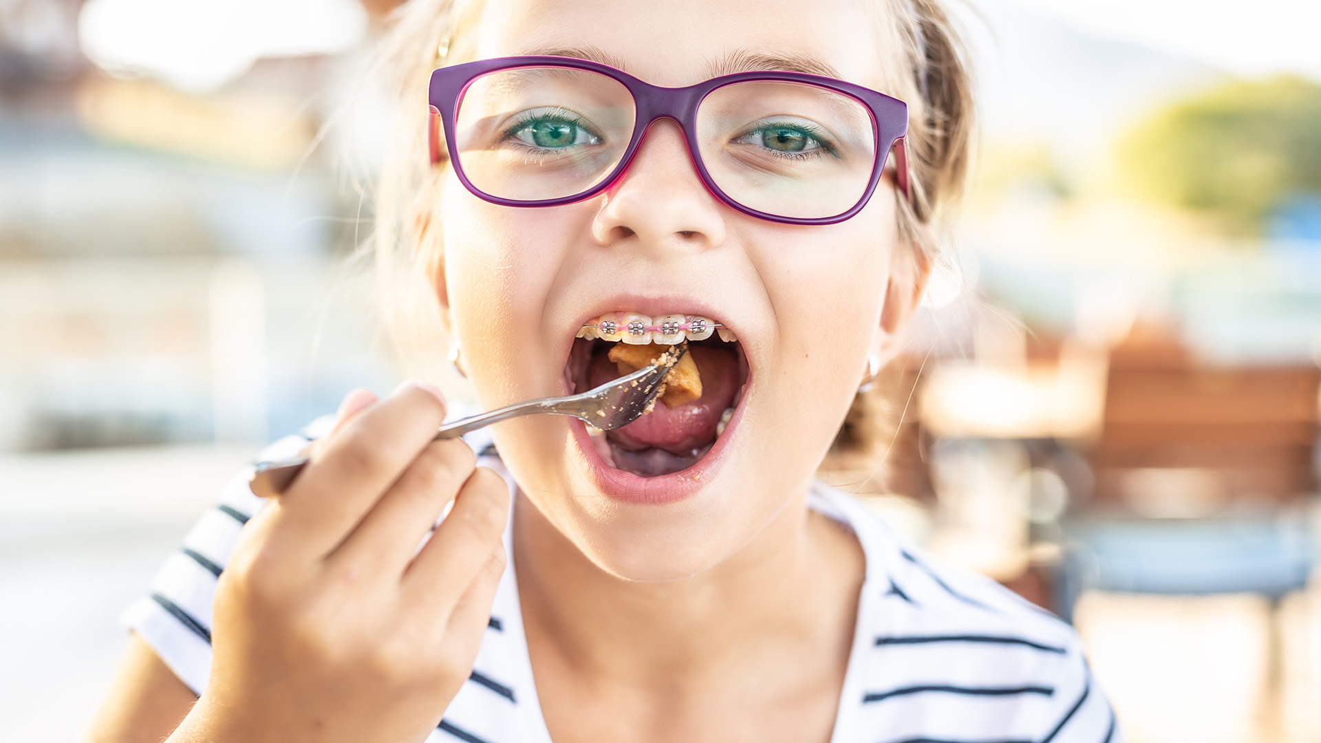 What to Eat When You Have Braces: A Practical Guide