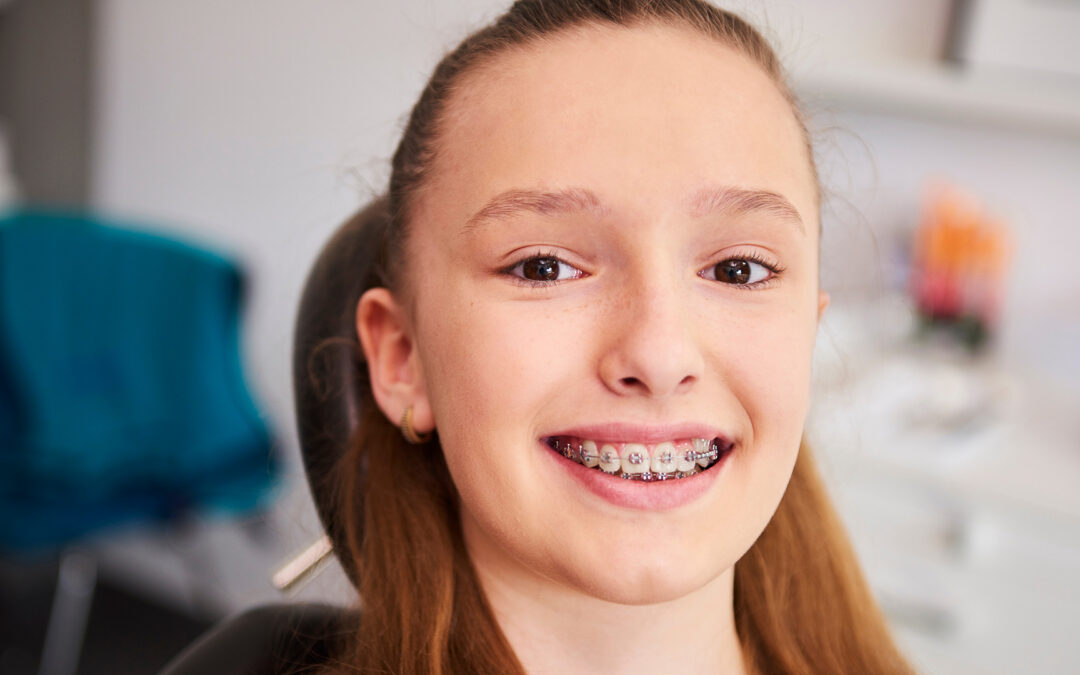 What to Expect From Your Smile After Braces
