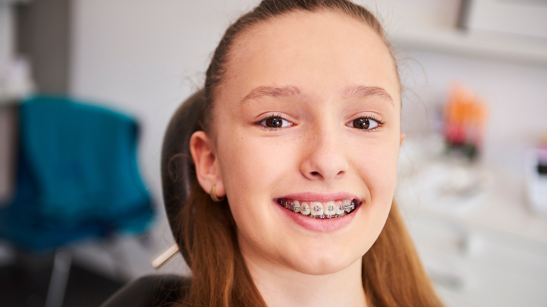 What to Expect From Your Smile After Braces
