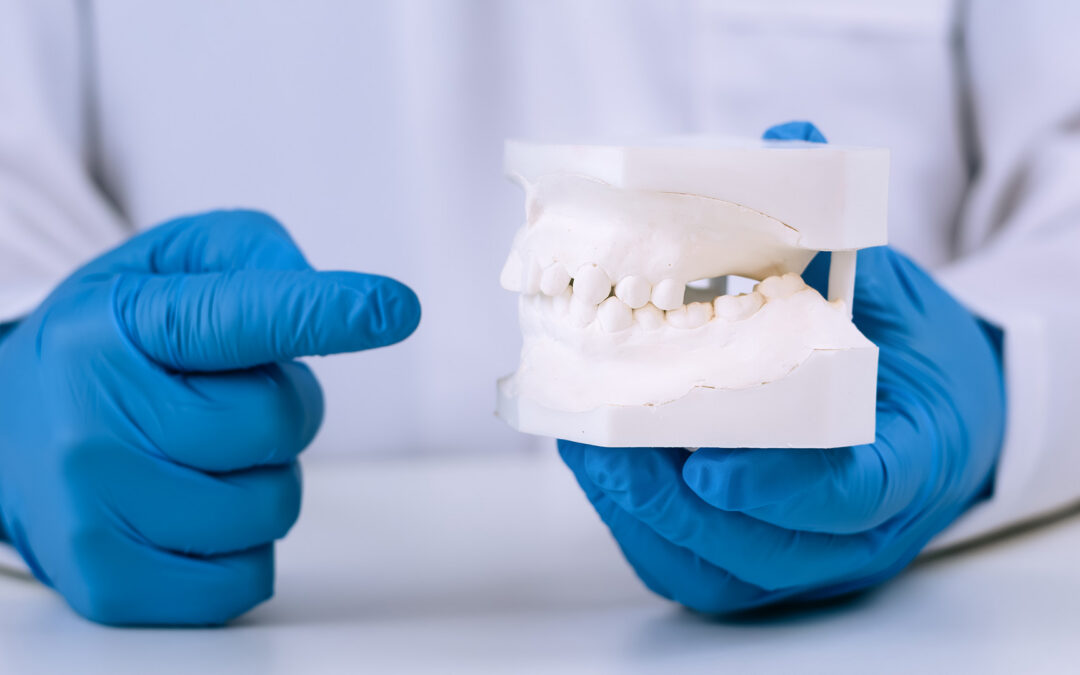 How to Fix an Underbite